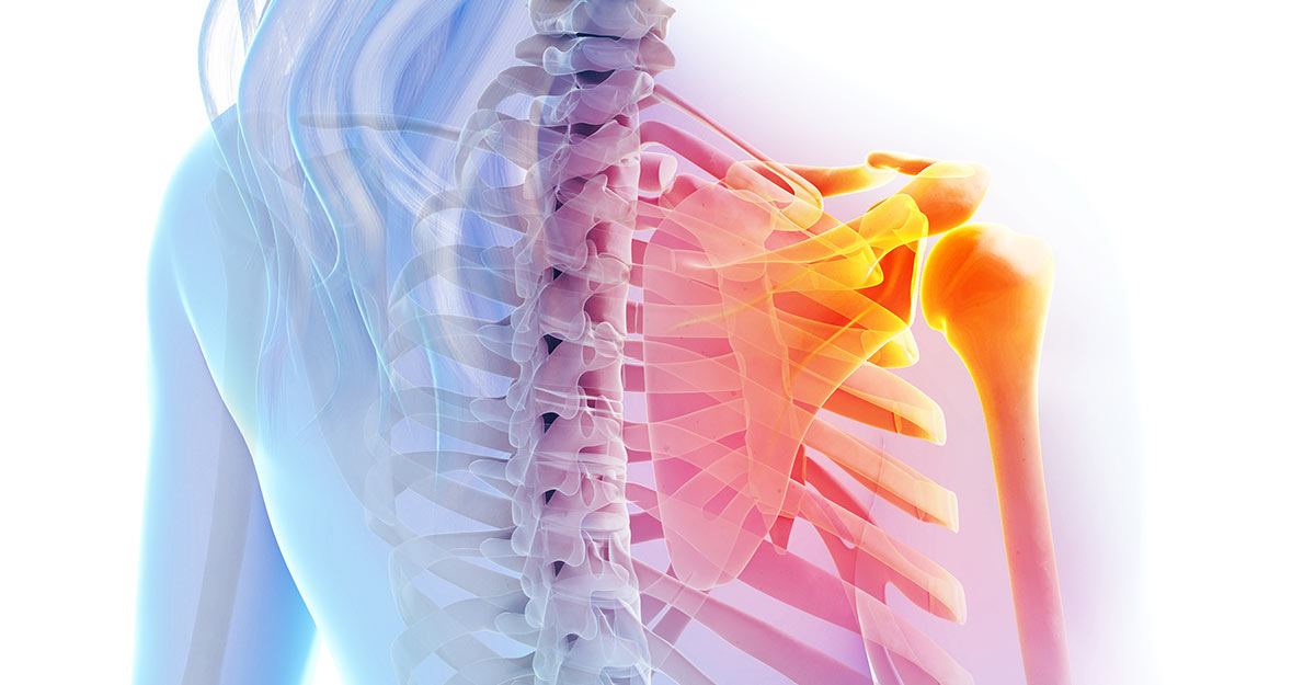 Gresham shoulder pain treatment and recovery