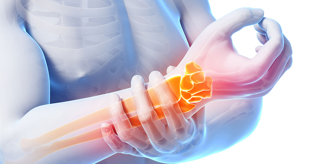 Gresham, OR natural carpal tunnel treatment